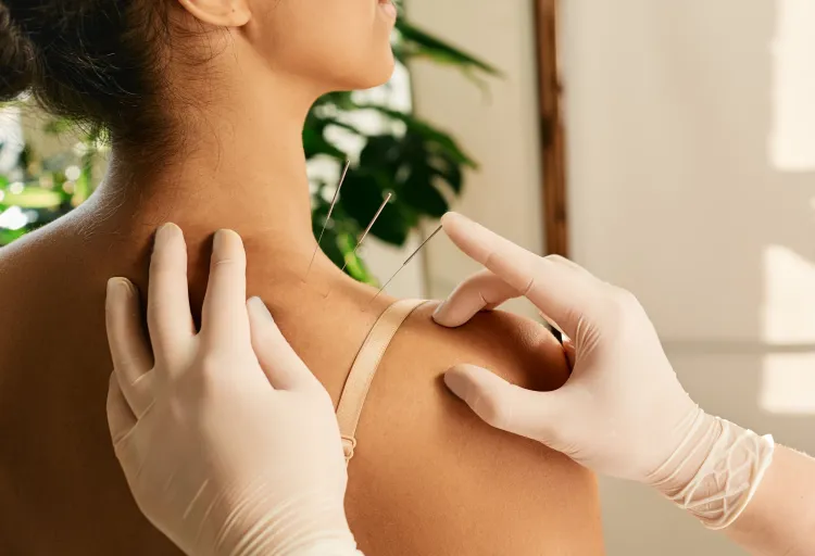 Acupuncture